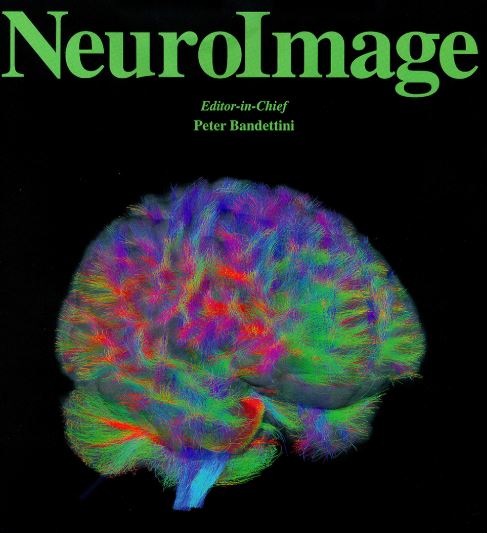 NeuroImage Journal