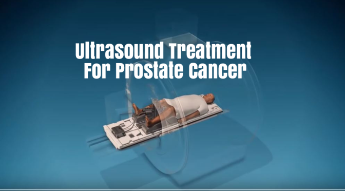 New Medical Innovations: Ultrasound Treatment For Prostate Cancer Proves 80% Effective