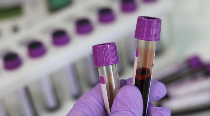 Medicine: ‘Single Drop’ Blood Testing Advances